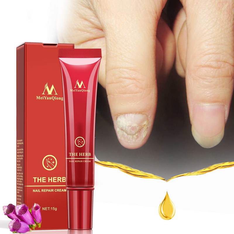 Toenail Fungus Treatment Cream Fast Nail Repair