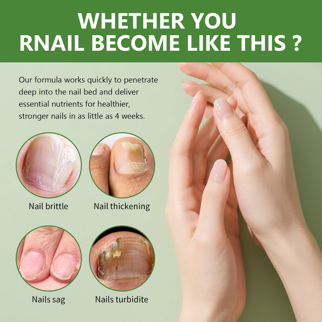 Nail Renewal Roll-On Serum for Men and Women